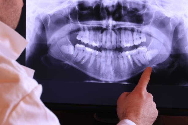 Best Emergency Denture Repair in Maple Lake, MN