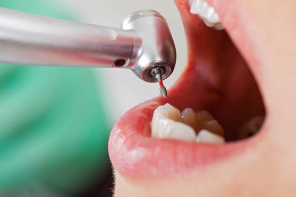 Best Emergency Gum Treatment in Maple Lake, MN